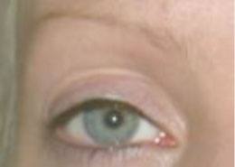 eyebrows_before eyebrows_before