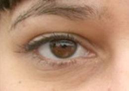 eyes_before eyes_before