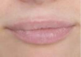 lips_before lips_before