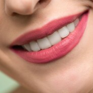 Does NHS cover teeth whitening?