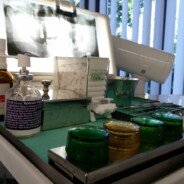What to Do in a Dental Emergency: A Patient Guide from a Dental Clinic in Catford